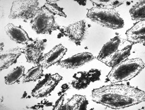 bone marrow … plasmocytoma (parafin-embedded sample) bone marrow … plasmocytoma (parafin-embedded sample)